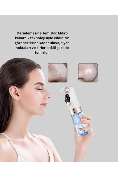 Titreşimli Elektrikli Gözenek Açıcı – Siyah Nokta ve Yağ Arındırıcı